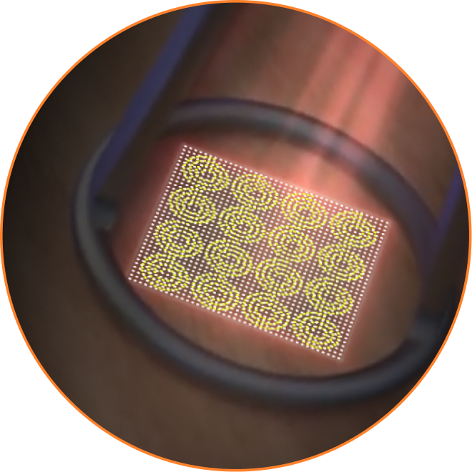 Detalhe da tecnologia Coring